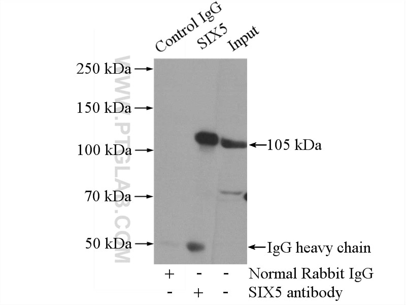 Immunoprecipitation (IP) experiment of Y79 cells using SIX5 Polyclonal antibody (22938-1-AP)