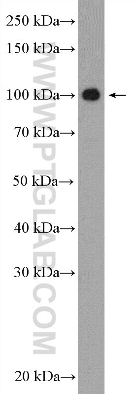 Western Blot (WB) analysis of Y79 cells using SIX5 Polyclonal antibody (22938-1-AP)