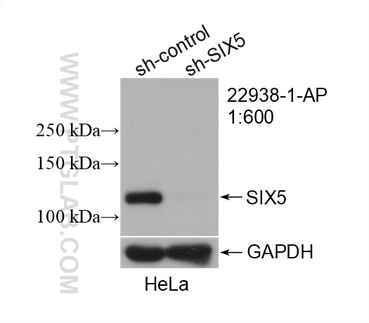 Western Blot (WB) analysis of HeLa cells using SIX5 Polyclonal antibody (22938-1-AP)