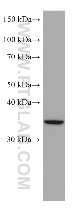 WB analysis of HUVEC using 67622-1-Ig