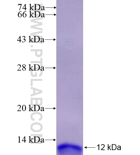 SIX6 fusion protein Ag15496 SDS-PAGE