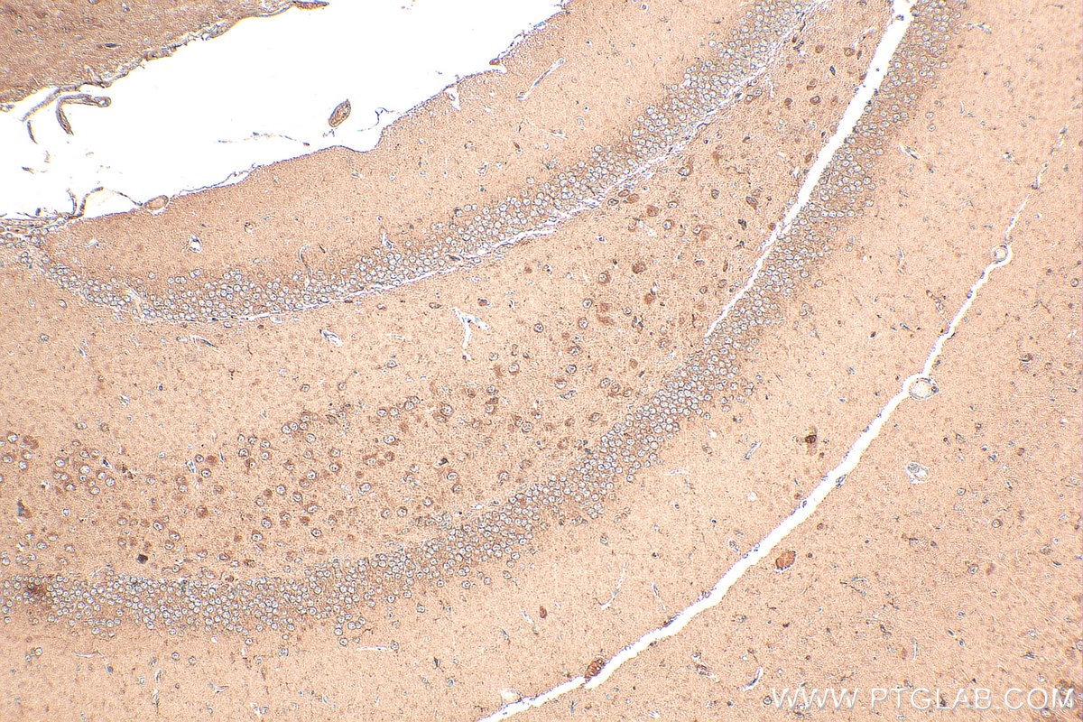 Immunohistochemistry (IHC) staining of mouse brain tissue using SKAP2 Polyclonal antibody (12926-1-AP)