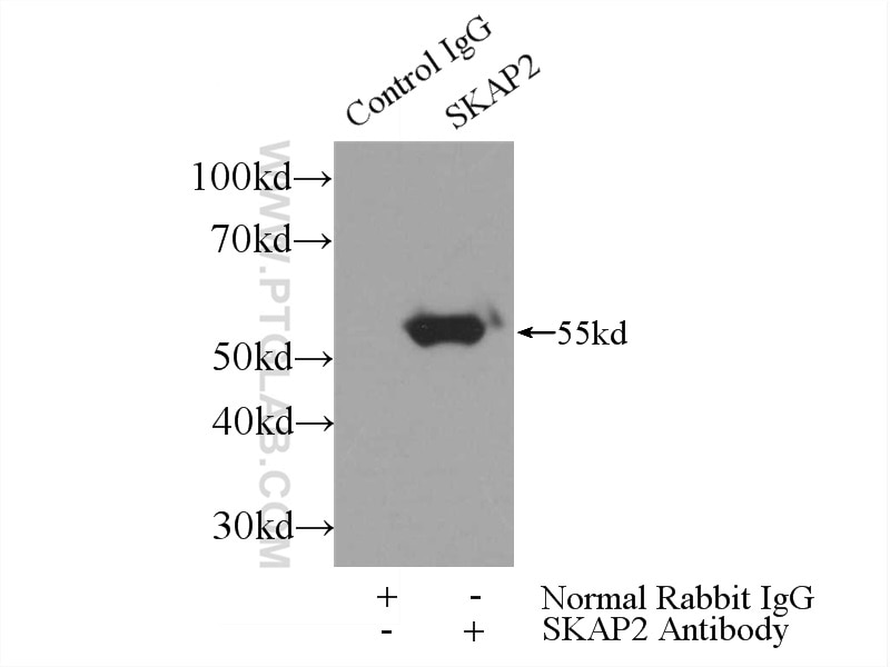 Immunoprecipitation (IP) experiment of mouse liver tissue using SKAP2 Polyclonal antibody (12926-1-AP)