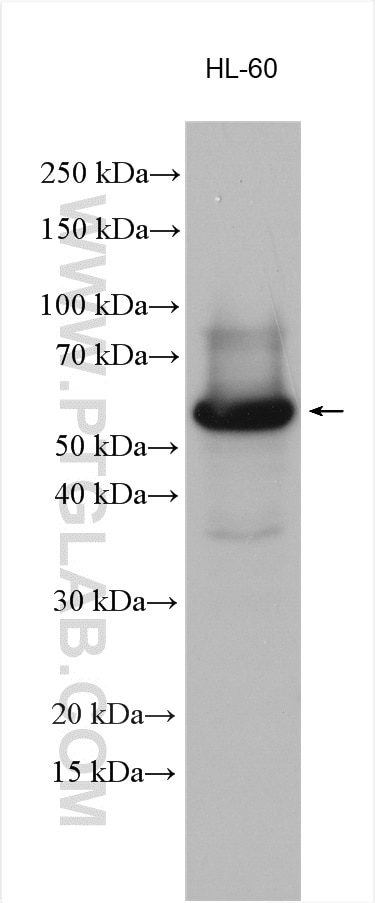 Western Blot (WB) analysis of HL-60 cells using SKAP2 Polyclonal antibody (12926-1-AP)