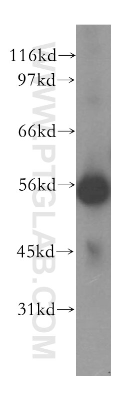 SKAP2 Polyclonal antibody