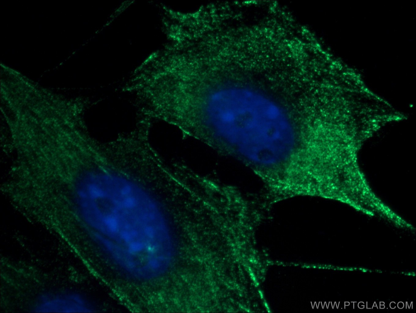 Immunofluorescence (IF) / fluorescent staining of NIH/3T3 cells using SKAP2 Monoclonal antibody (66367-1-Ig)