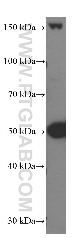 Western Blot (WB) analysis of human spleen tissue using SKAP2 Monoclonal antibody (66367-1-Ig)