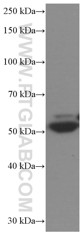 Western Blot (WB) analysis of pig liver tissue using SKAP2 Monoclonal antibody (66367-1-Ig)