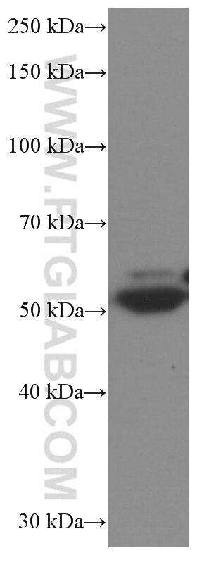 Western Blot (WB) analysis of pig liver tissue using SKAP2 Monoclonal antibody (66367-1-Ig)