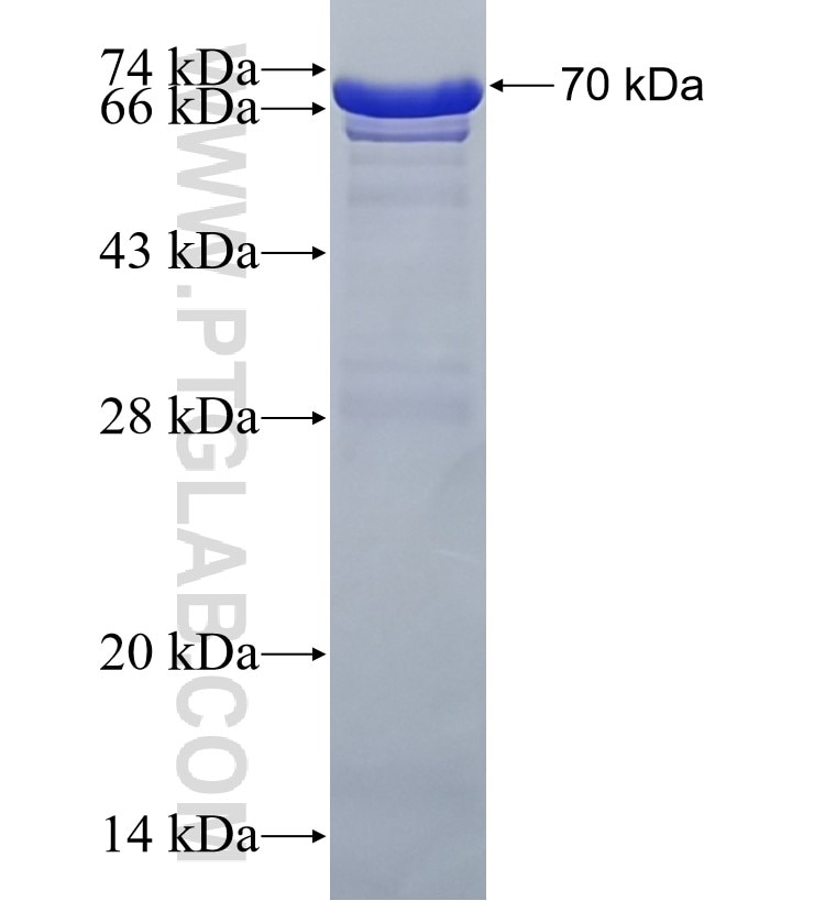 SKAP2 fusion protein Ag3615 SDS-PAGE