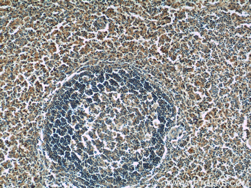 Immunohistochemistry (IHC) staining of human spleen tissue using SKAP55 Polyclonal antibody (14724-1-AP)