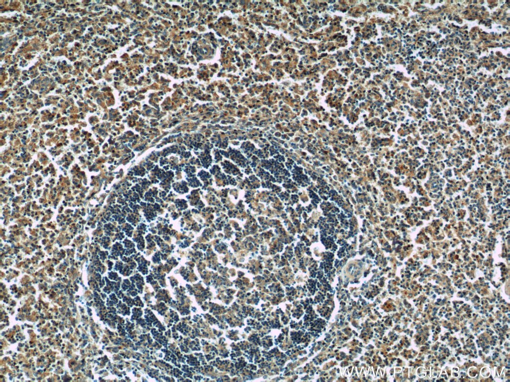 IHC staining of human spleen using 14724-1-AP