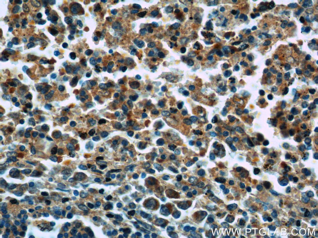 Immunohistochemistry (IHC) staining of human spleen tissue using SKAP55 Polyclonal antibody (14724-1-AP)