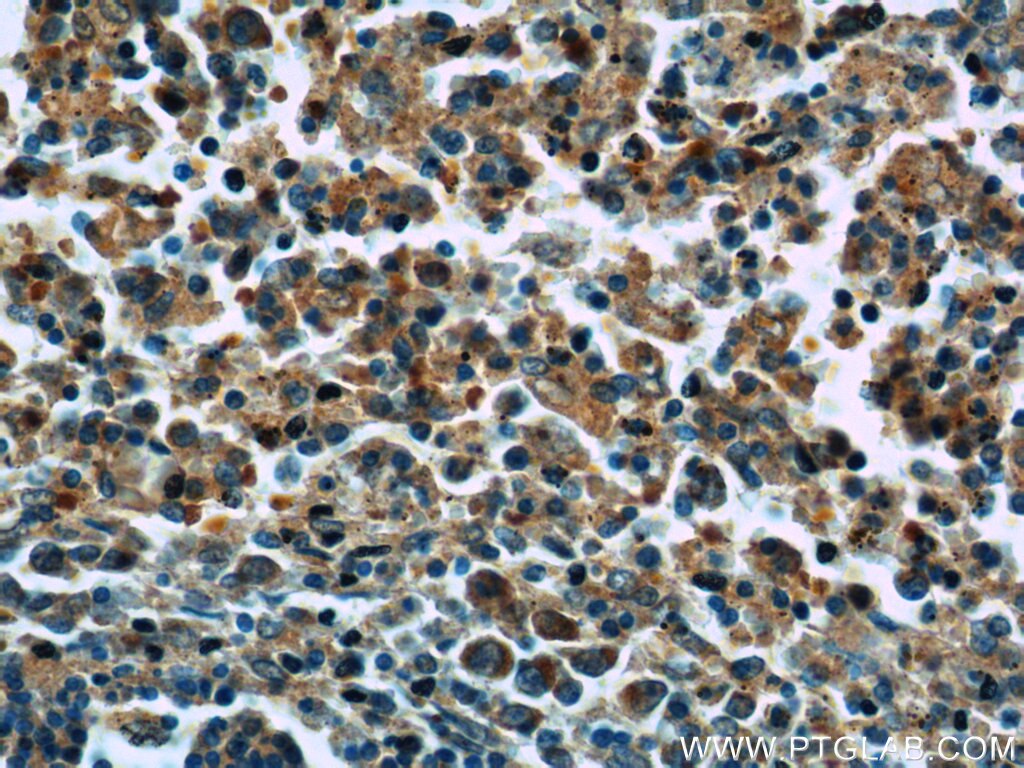 IHC staining of human spleen using 14724-1-AP