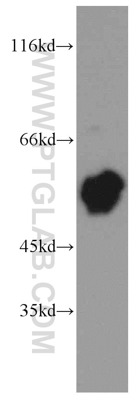 Western Blot (WB) analysis of mouse thymus tissue using SKAP55 Polyclonal antibody (14724-1-AP)