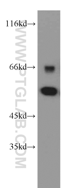 Western Blot (WB) analysis of Jurkat cells using SKAP55 Polyclonal antibody (14724-1-AP)