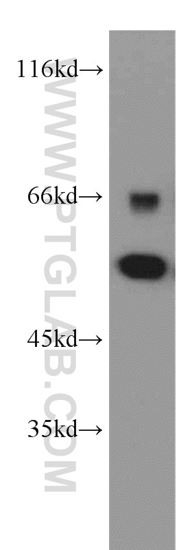 WB analysis of Jurkat using 14724-1-AP
