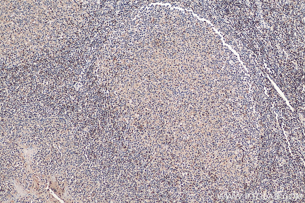 Immunohistochemistry (IHC) staining of human tonsillitis tissue using SKAP55 Polyclonal antibody (19247-1-AP)
