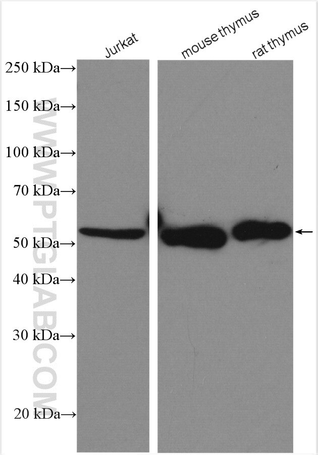 Western Blot (WB) analysis of various lysates using SKAP55 Polyclonal antibody (19247-1-AP)