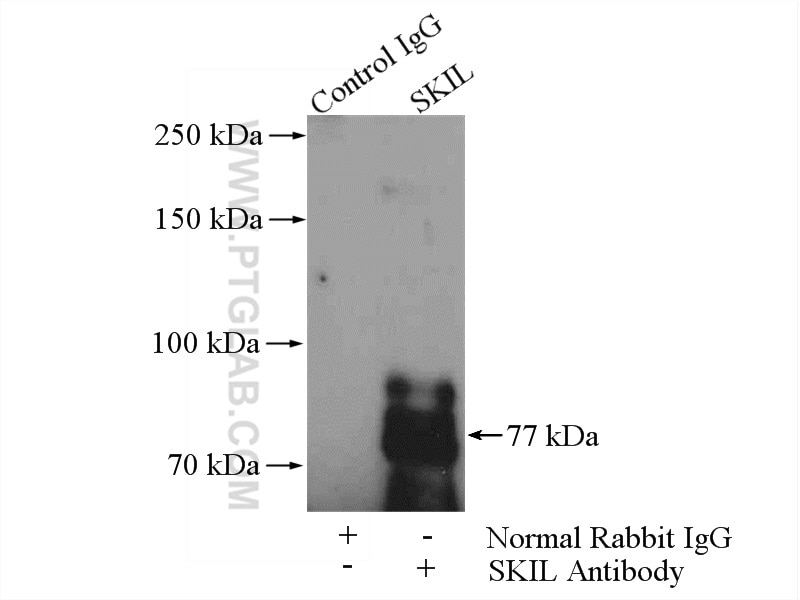 Immunoprecipitation (IP) experiment of HepG2 cells using SKIL Polyclonal antibody (19218-1-AP)