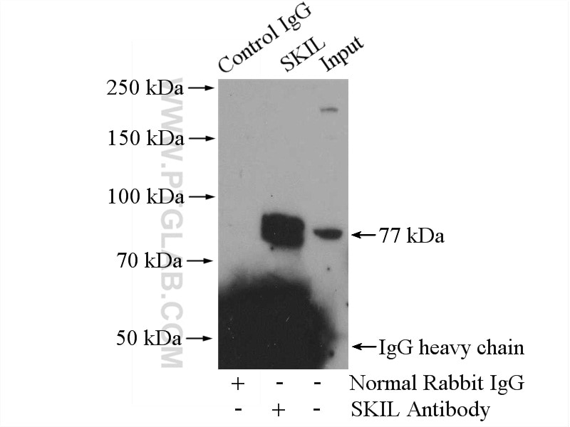 Immunoprecipitation (IP) experiment of HepG2 cells using SKIL Polyclonal antibody (19218-1-AP)