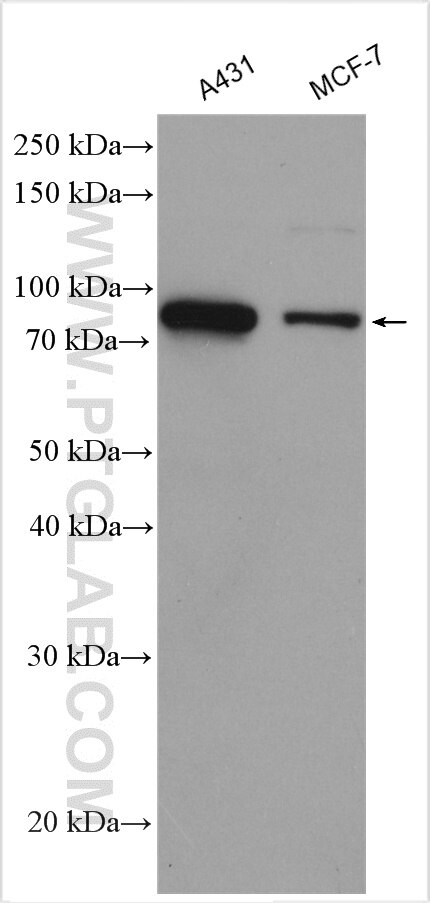 Western Blot (WB) analysis of various lysates using SKIL Polyclonal antibody (19218-1-AP)