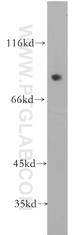 Western Blot (WB) analysis of human skeletal muscle tissue using SKIL Polyclonal antibody (19218-1-AP)