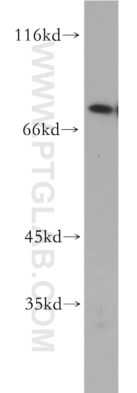 Western Blot (WB) analysis of A431 cells using SKIL Polyclonal antibody (19218-1-AP)