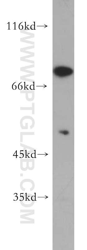 Western Blot (WB) analysis of A431 cells using SKIL Polyclonal antibody (19218-1-AP)