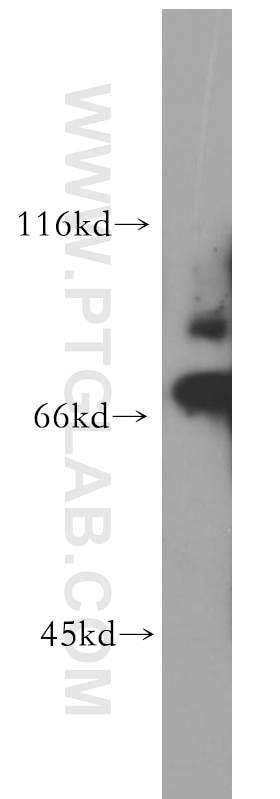 Western Blot (WB) analysis of HepG2 cells using SKIL Polyclonal antibody (19218-1-AP)