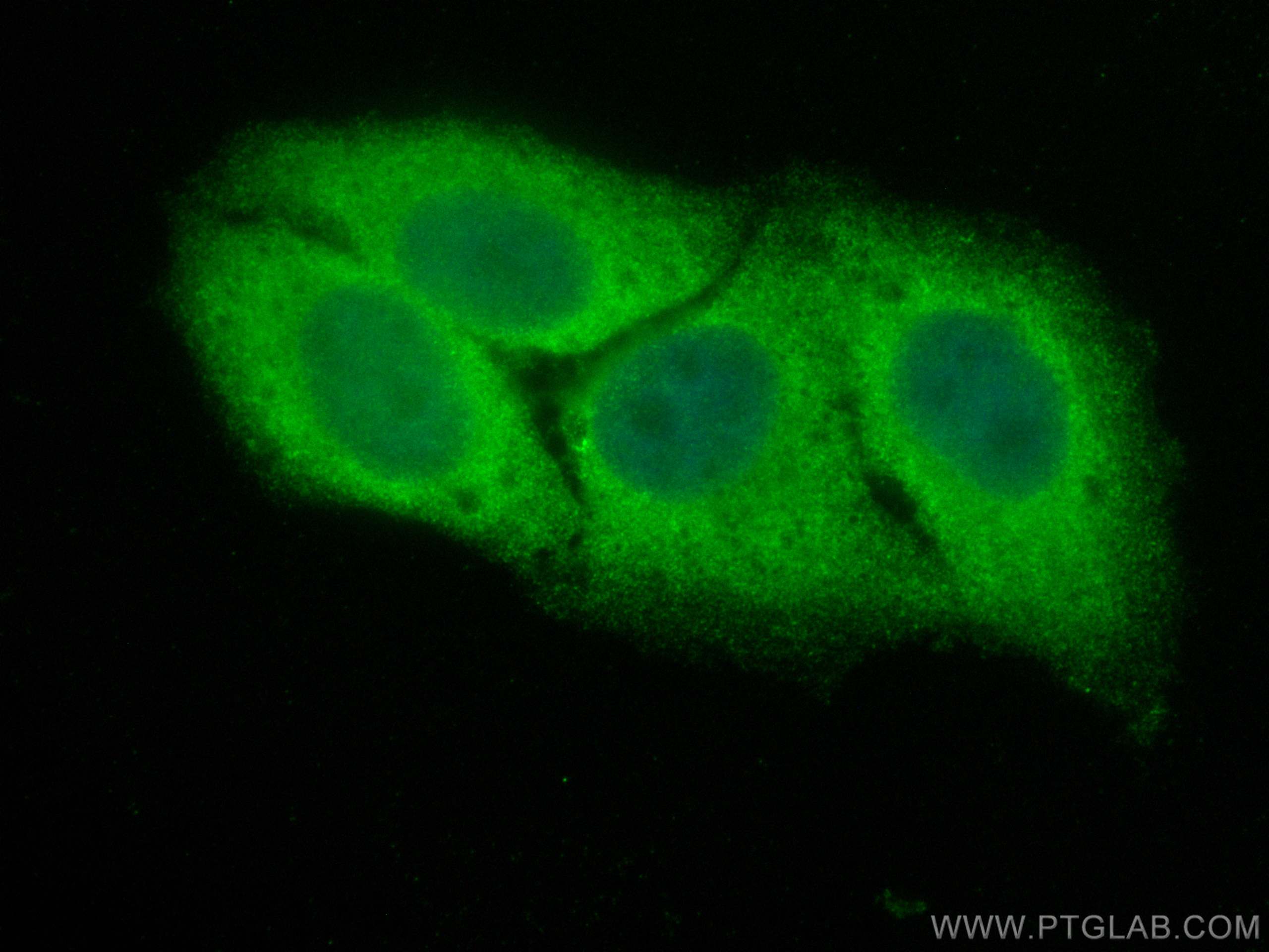 Immunofluorescence (IF) / fluorescent staining of HepG2 cells using CoraLite® Plus 488-conjugated SKIL Polyclonal anti (CL488-19218)