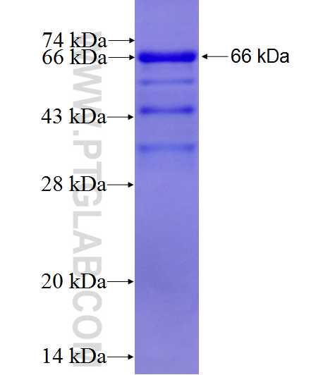 SKIL fusion protein Ag4948 SDS-PAGE