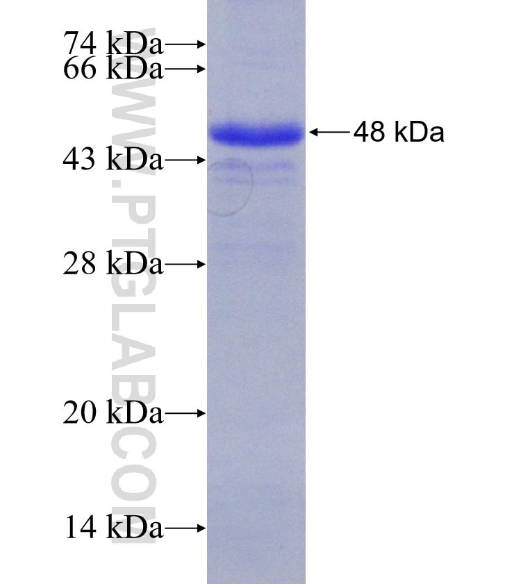 SKIL fusion protein Ag5282 SDS-PAGE