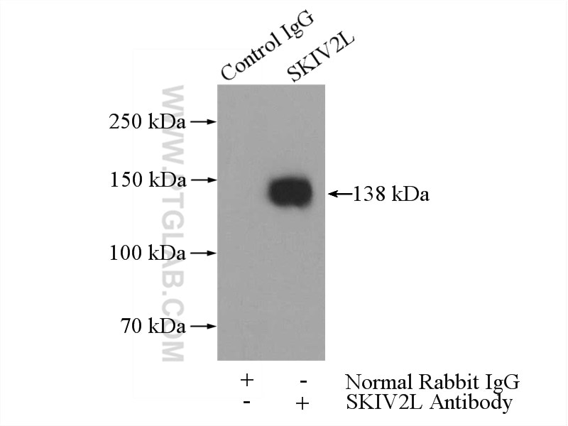 Immunoprecipitation (IP) experiment of HepG2 cells using SKIV2L Polyclonal antibody (11462-1-AP)