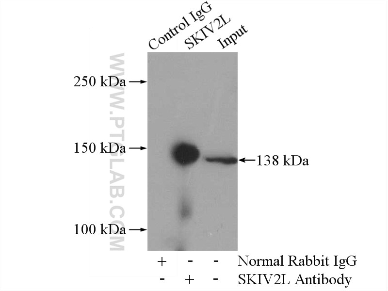 Immunoprecipitation (IP) experiment of HepG2 cells using SKIV2L Polyclonal antibody (11462-1-AP)