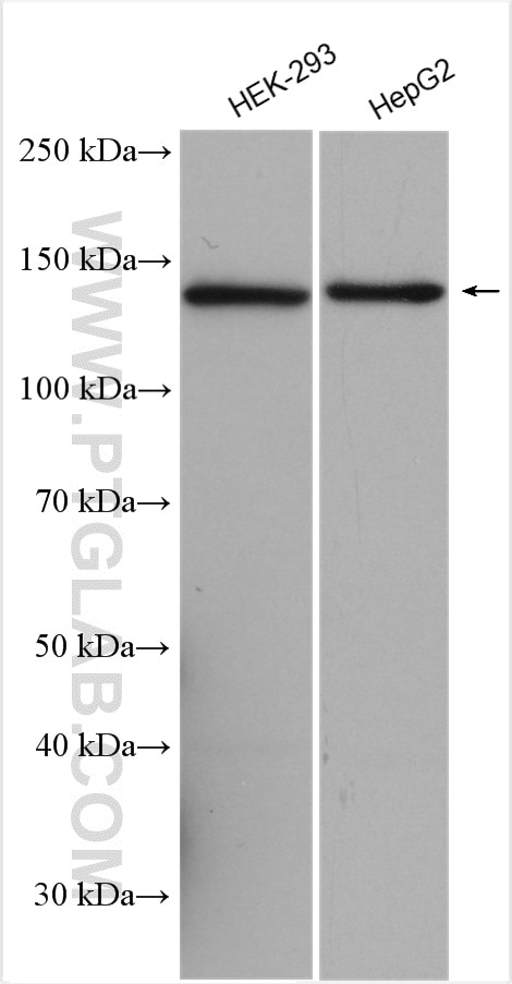 Western Blot (WB) analysis of various lysates using SKIV2L Polyclonal antibody (11462-1-AP)