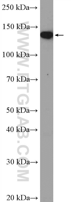 Western Blot (WB) analysis of COLO 320 cells using SKIV2L Polyclonal antibody (11462-1-AP)