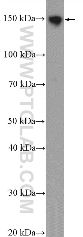 Western Blot (WB) analysis of COLO 320 cells using SKIV2L Polyclonal antibody (11462-1-AP)