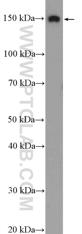 Western Blot (WB) analysis of COLO 320 cells using SKIV2L Polyclonal antibody (11462-1-AP)