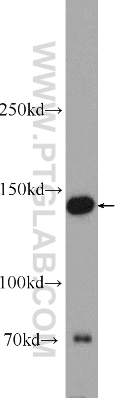Western Blot (WB) analysis of HepG2 cells using SKIV2L Polyclonal antibody (11462-1-AP)