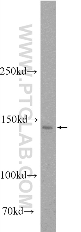 Western Blot (WB) analysis of Jurkat cells using SKIV2L Polyclonal antibody (11462-1-AP)