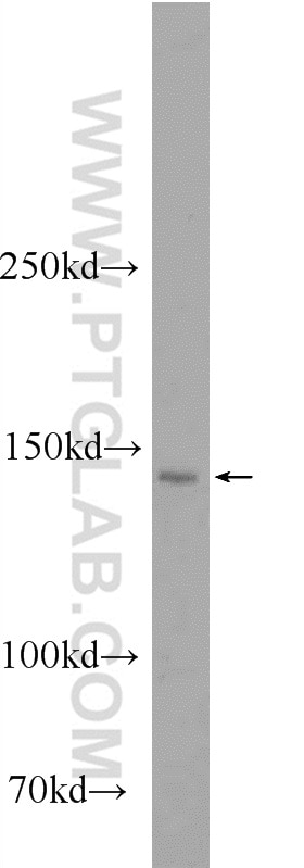 WB analysis of Jurkat using 11462-1-AP