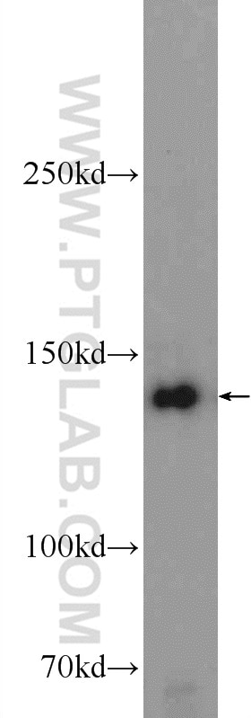 Western Blot (WB) analysis of HEK-293 cells using SKIV2L Polyclonal antibody (11462-1-AP)