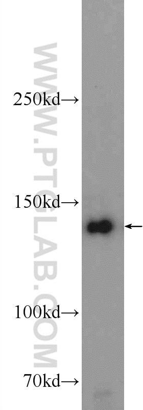 SKIV2L Polyclonal antibody