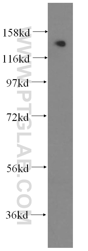 Western Blot (WB) analysis of human kidney tissue using SKIV2L Polyclonal antibody (11462-1-AP)