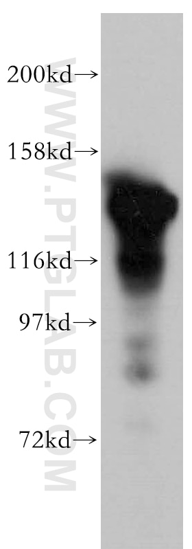 Western Blot (WB) analysis of HEK-293 cells using SKIV2L Polyclonal antibody (11462-1-AP)