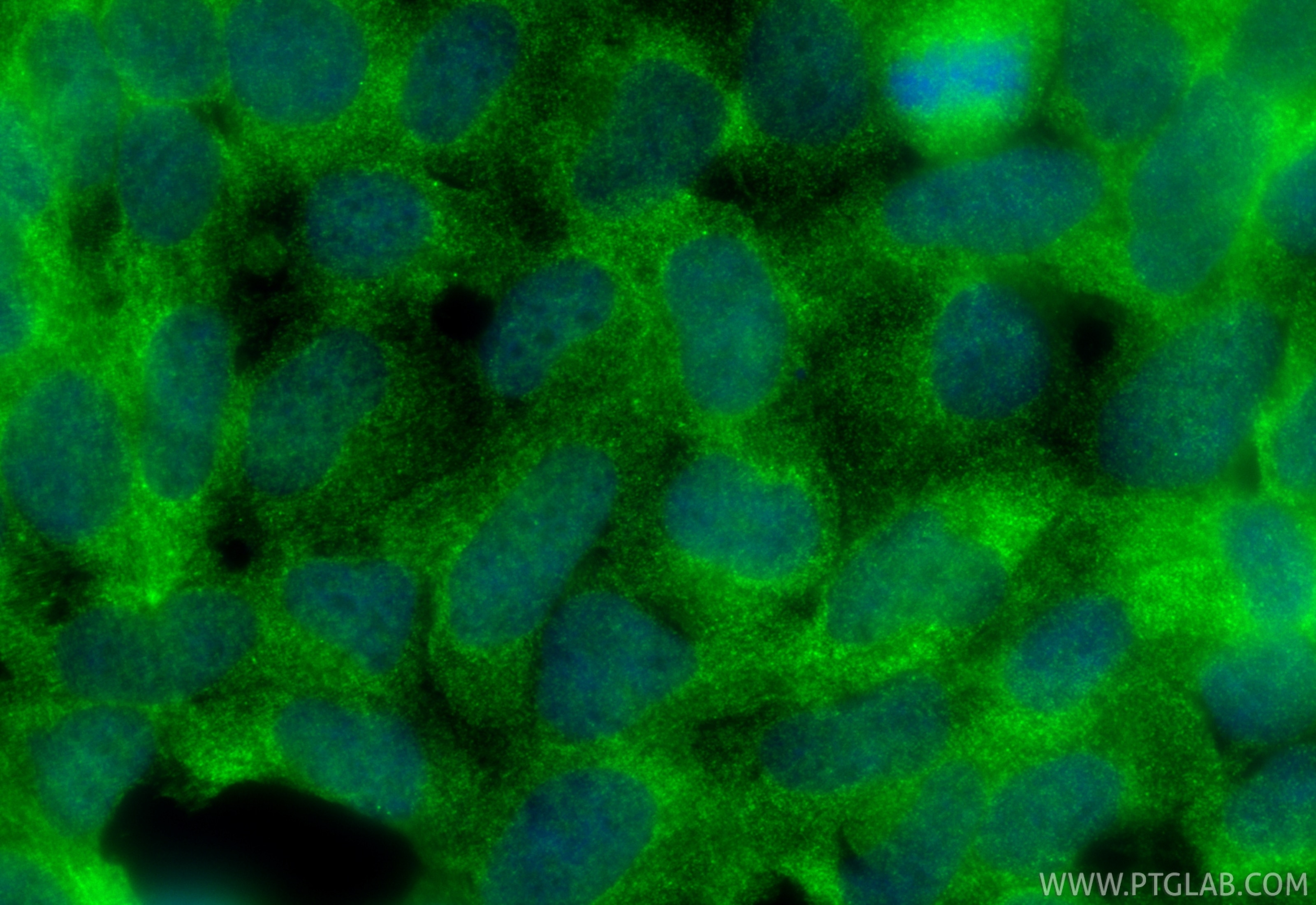 Immunofluorescence (IF) / fluorescent staining of HEK-293 cells using SKIV2L Monoclonal antibody (68547-1-Ig)