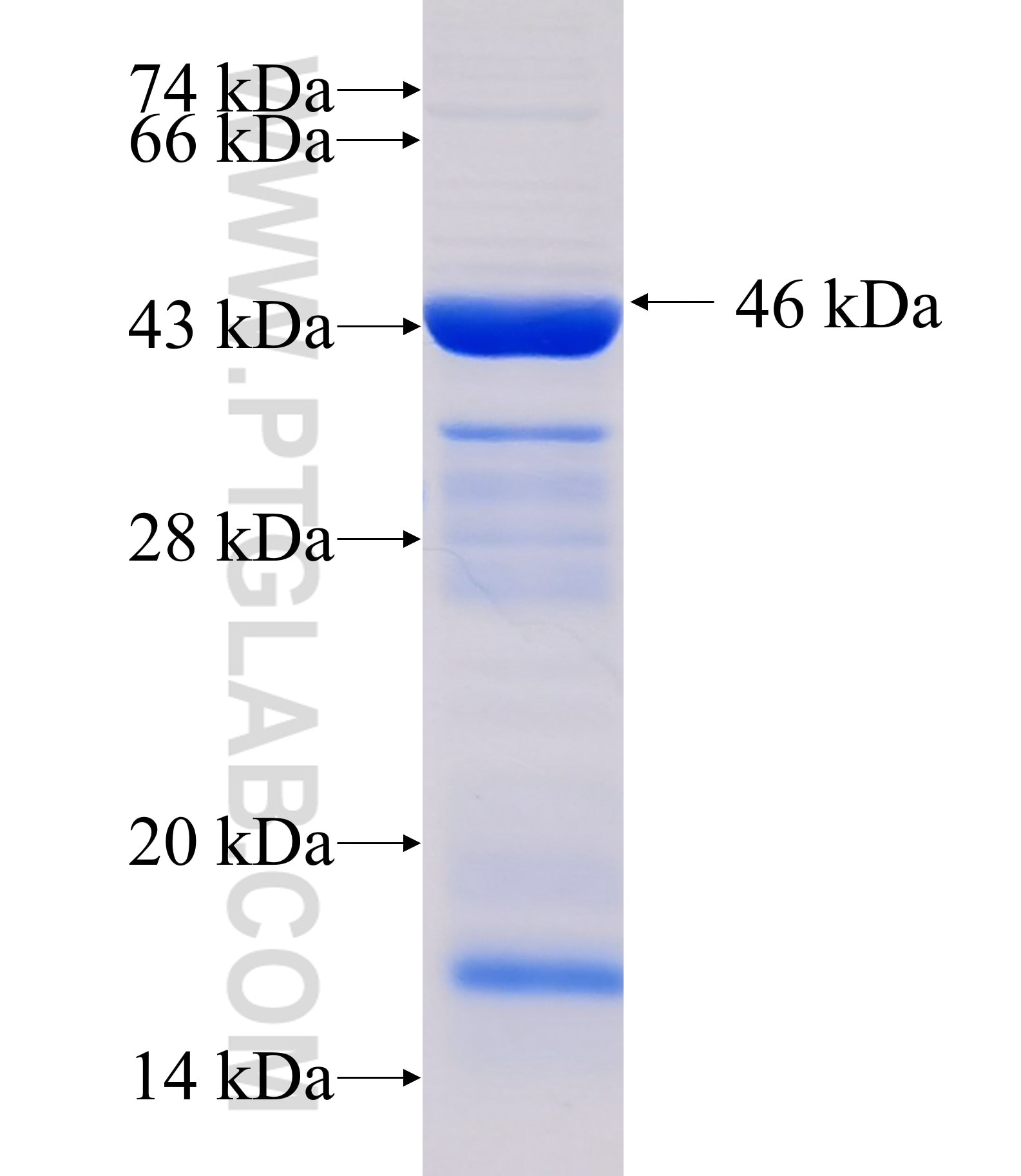 SKIV2L fusion protein Ag33679 SDS-PAGE