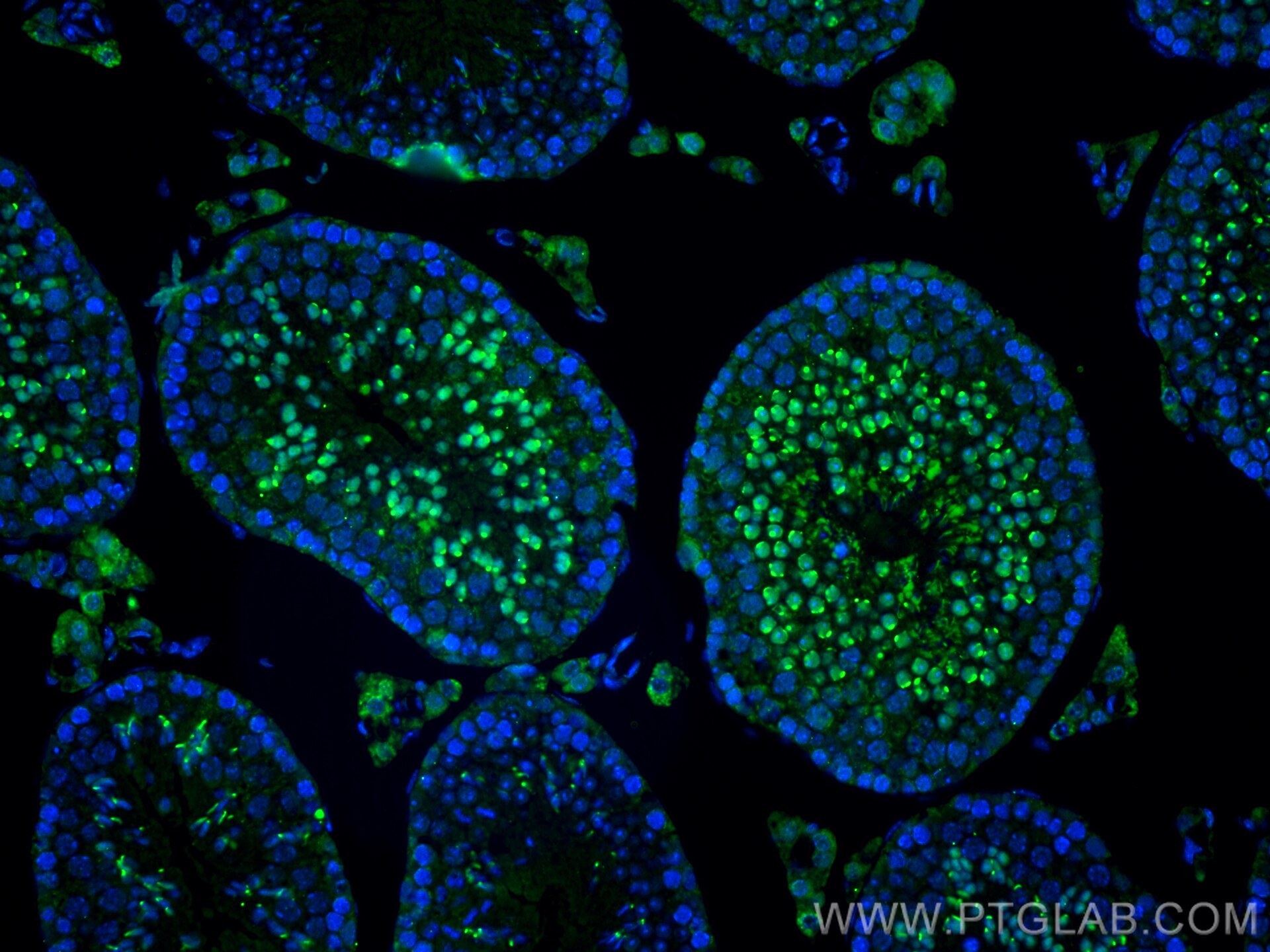 Immunofluorescence (IF) / fluorescent staining of mouse testis tissue using SKIV2L2 Polyclonal antibody (12719-2-AP)