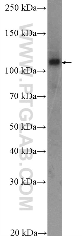 Western Blot (WB) analysis of HepG2 cells using SKIV2L2 Polyclonal antibody (12719-2-AP)